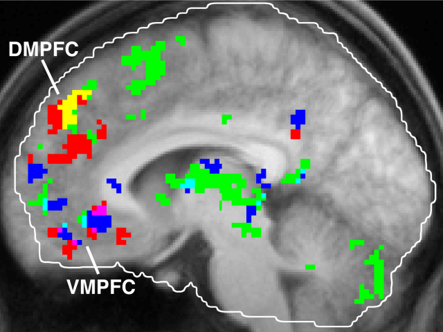 brain slice with colored activity